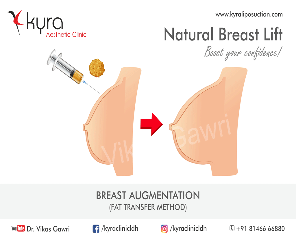 Fat Transfer To Breast In Ludhiana