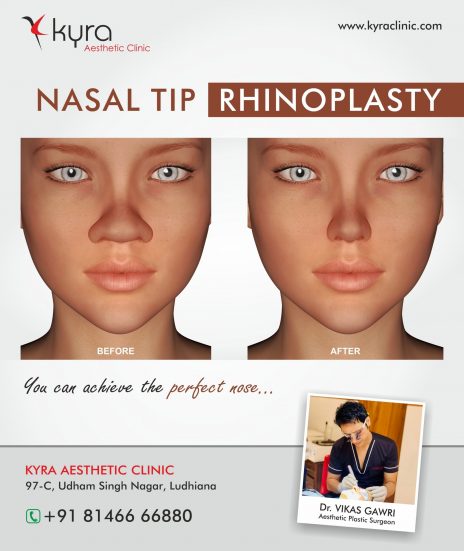 Types of Rhinoplasty - Cosmetic Surgery in Ludhiana, Plastic Surgery in ...