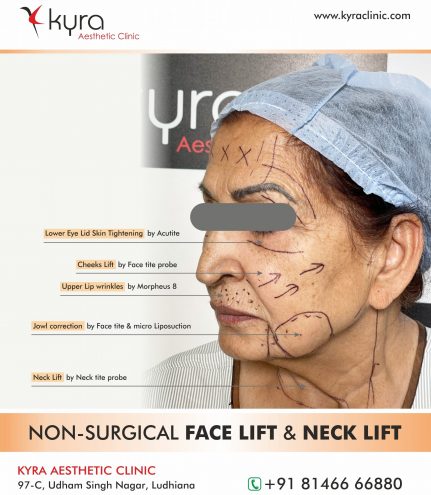 Non-Surgical Skin Tightening  The American Board of Cosmetic Surgery